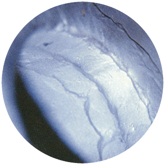 fractured damage repairs